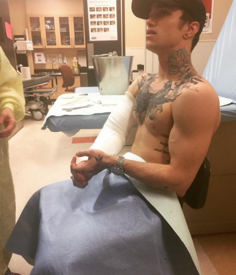 Jake Bass broken arm